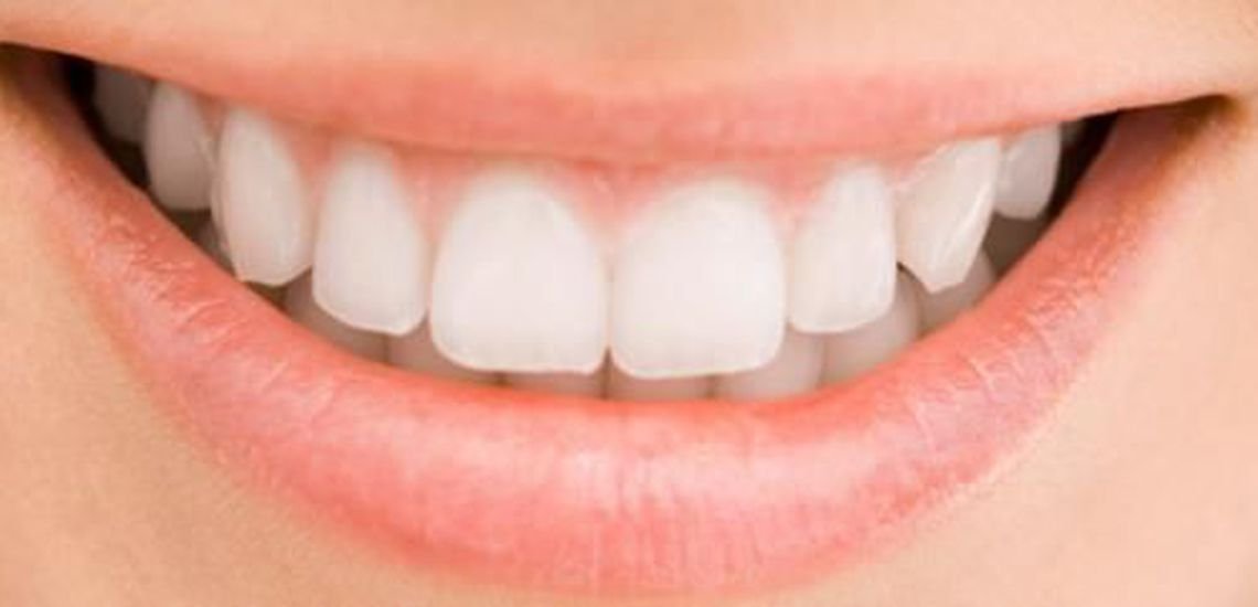 implantes-dentales-analisis-de-las-ventajas-y-desventajas-para-una-sonrisa-permanente