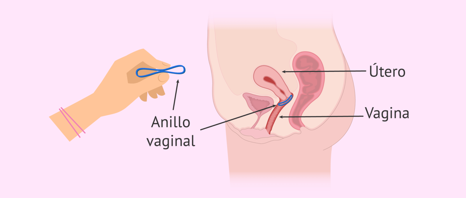 analisis-de-las-ventajas-y-desventajas-de-los-metodos-anticonceptivos-con-anillo-vaginal-todo-lo-que-debes-saber